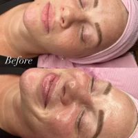 Victorious Aesthetics ico