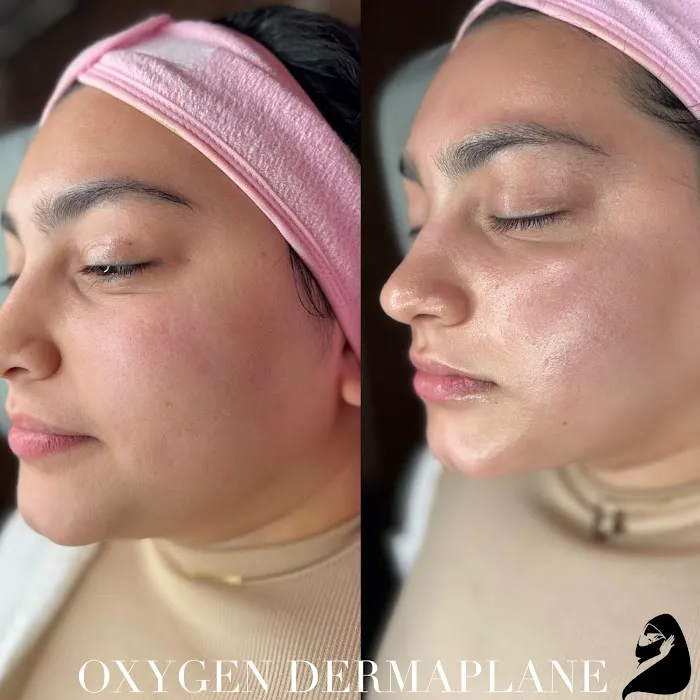 Victorious Aesthetics Picture 7