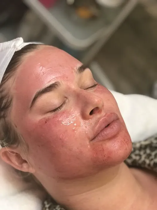 Victorious Aesthetics Picture 5