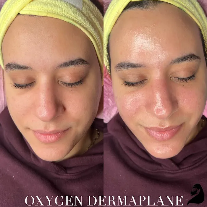 Victorious Aesthetics Picture 10