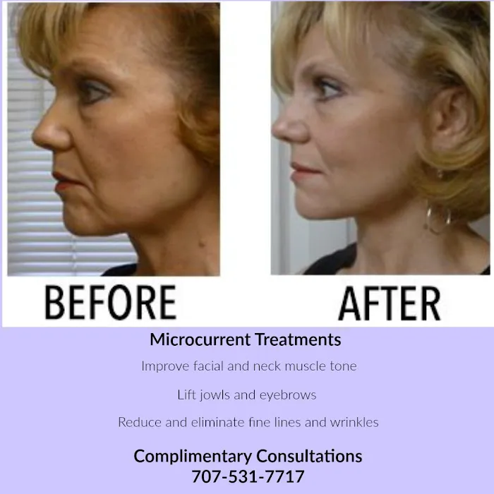 Purre Face & Body Picture 6