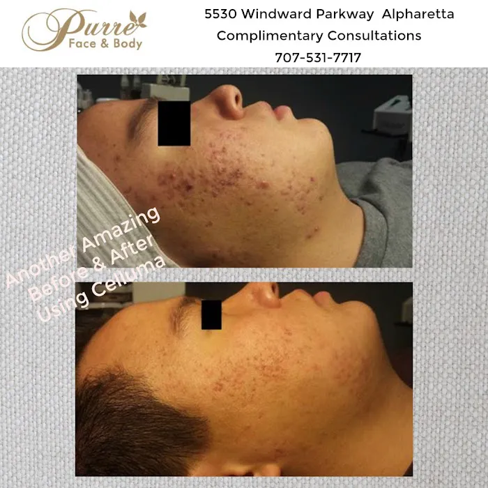 Purre Face & Body Picture 8