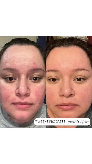 Genuine Beauty - Facials + Brows Picture 4