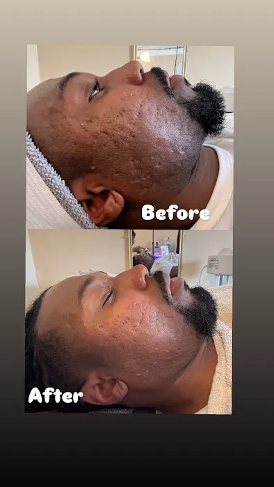 Forever Beauty Skin Rejuvenation LLC Picture 10