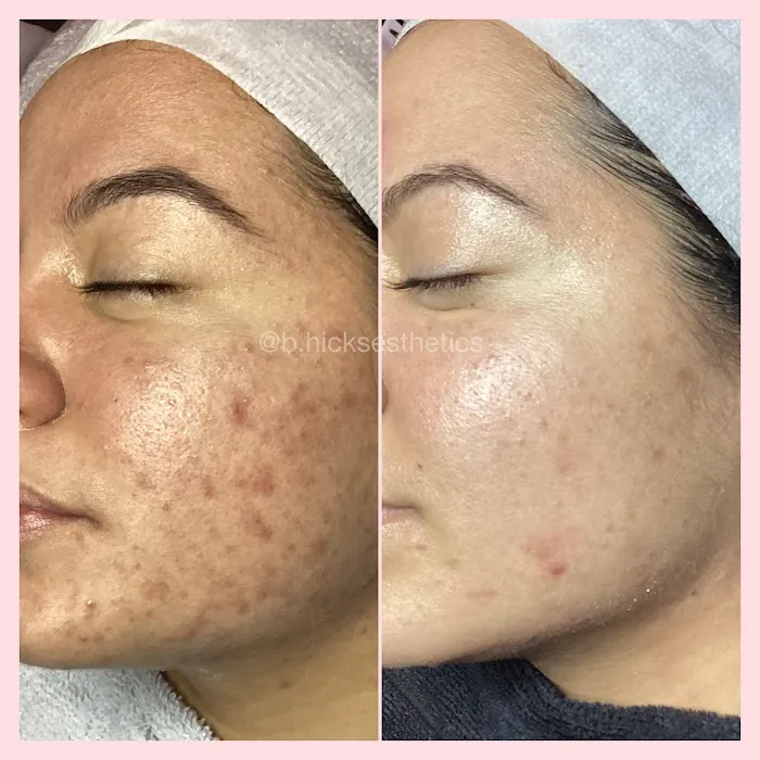 B Hicks Esthetics Picture 3