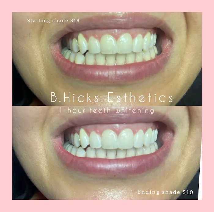 B Hicks Esthetics Picture 4