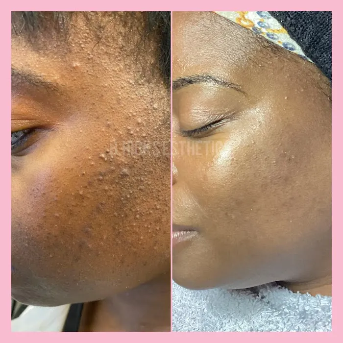 B Hicks Esthetics Picture 6