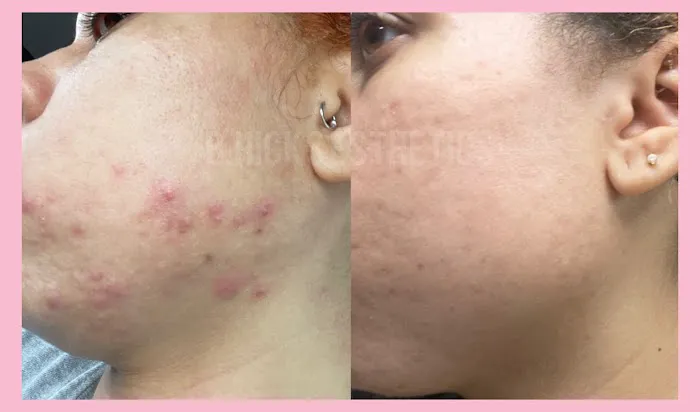 B Hicks Esthetics Picture 5