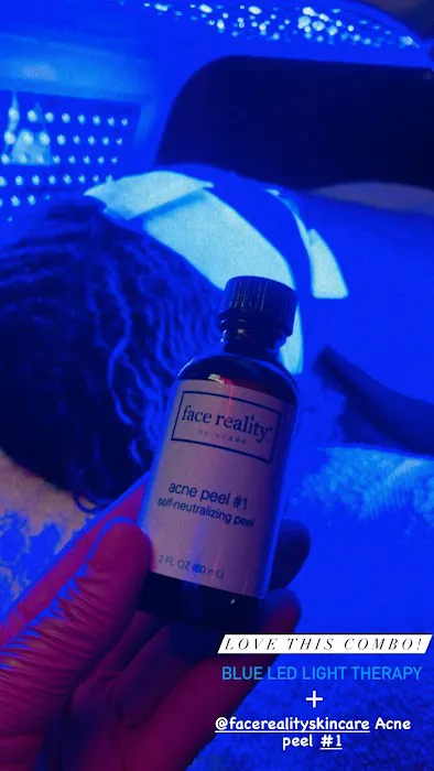 B Hicks Esthetics Picture 10