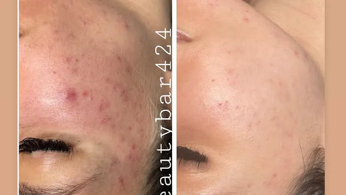 Beautybar424 Picture 2