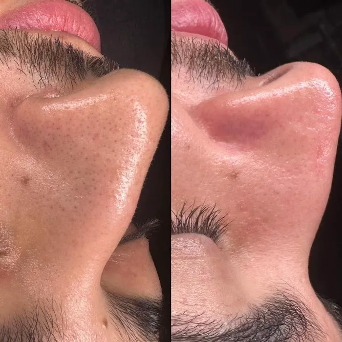 Dina Aesthetics Picture 5