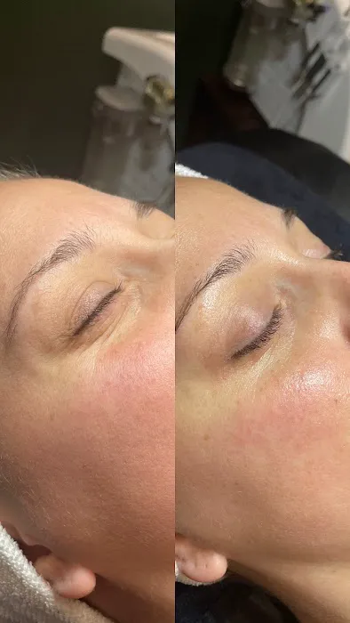 Alexxa Esthetic Picture 8