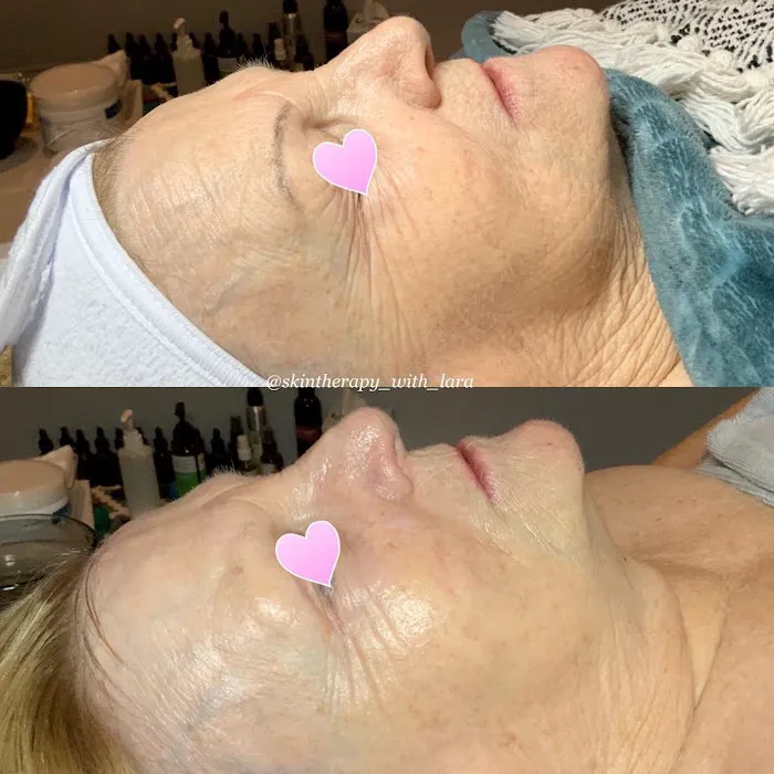 Skin Therapy with Lara Picture 2