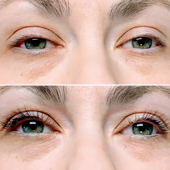 Skin Therapy with Lara Picture 4