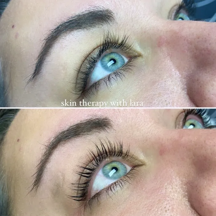 Skin Therapy with Lara Picture 5