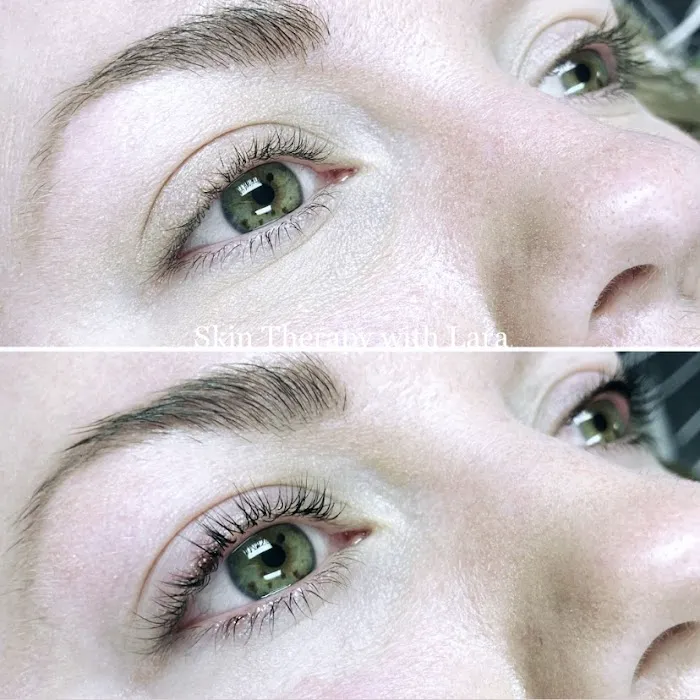 Skin Therapy with Lara Picture 7