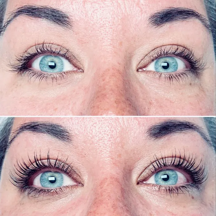 Skin Therapy with Lara Picture 8