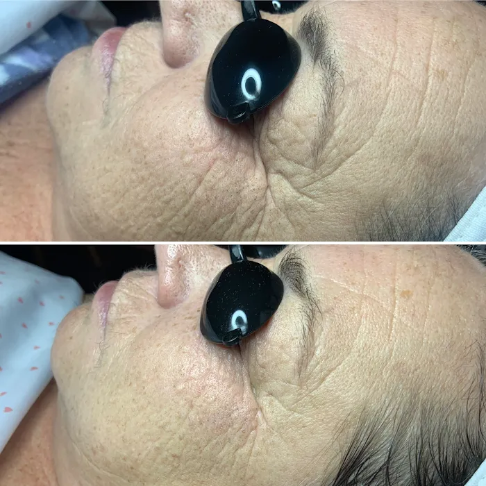 Skin Therapy with Lara Picture 10