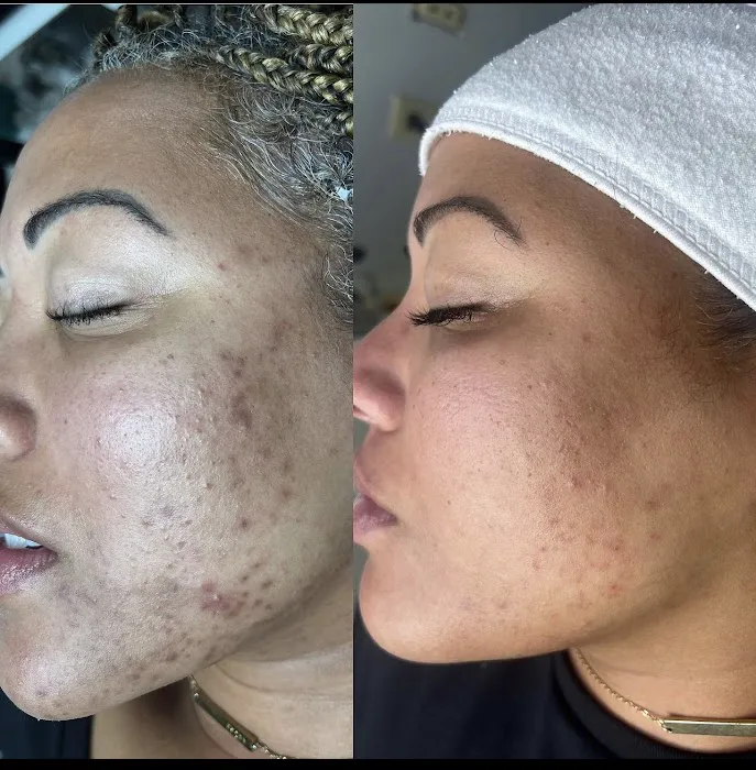 Nourished SKN Picture 5