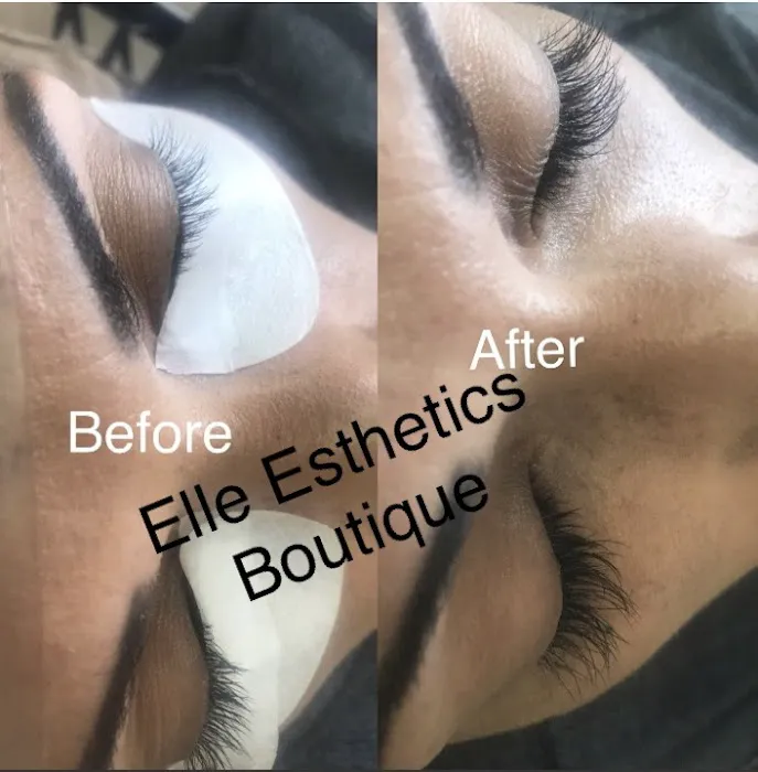 Elle Esthetics Boutique LLC Picture 3