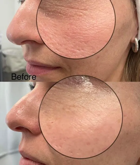 Prerequisite Beauty Picture 7