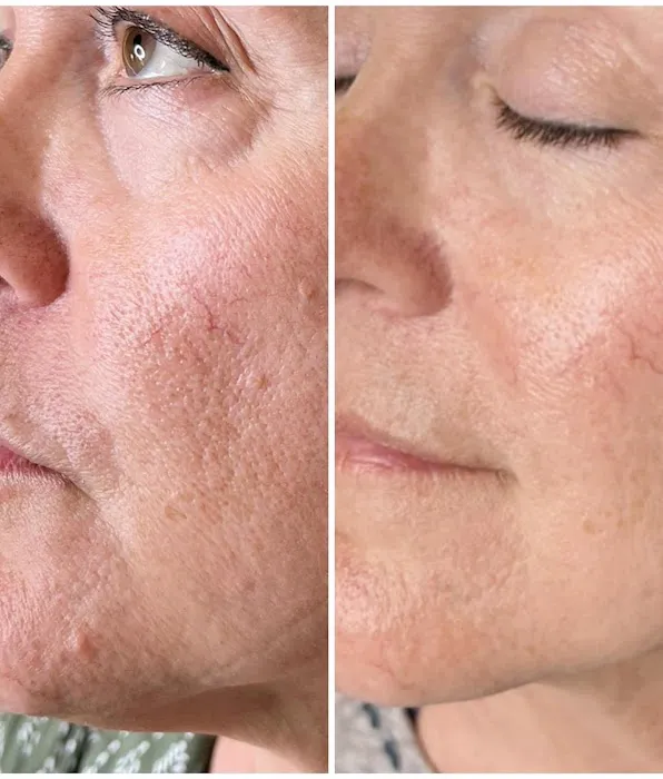 Prerequisite Beauty Picture 8