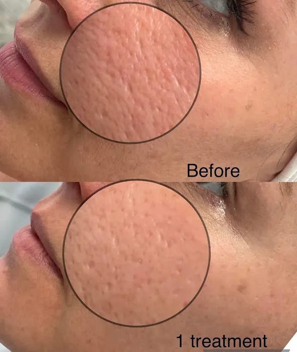 Prerequisite Beauty Picture 10