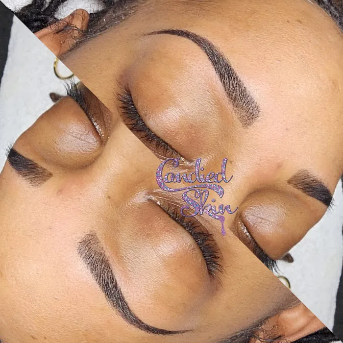 Candied Skin Picture 2