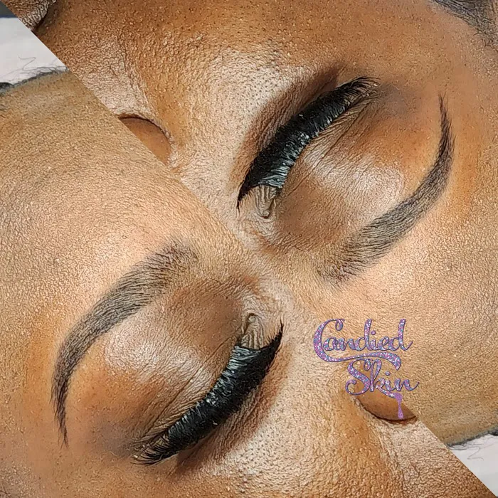 Candied Skin Picture 1