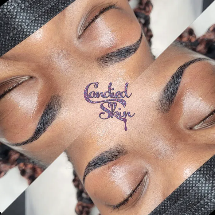 Candied Skin Picture 3