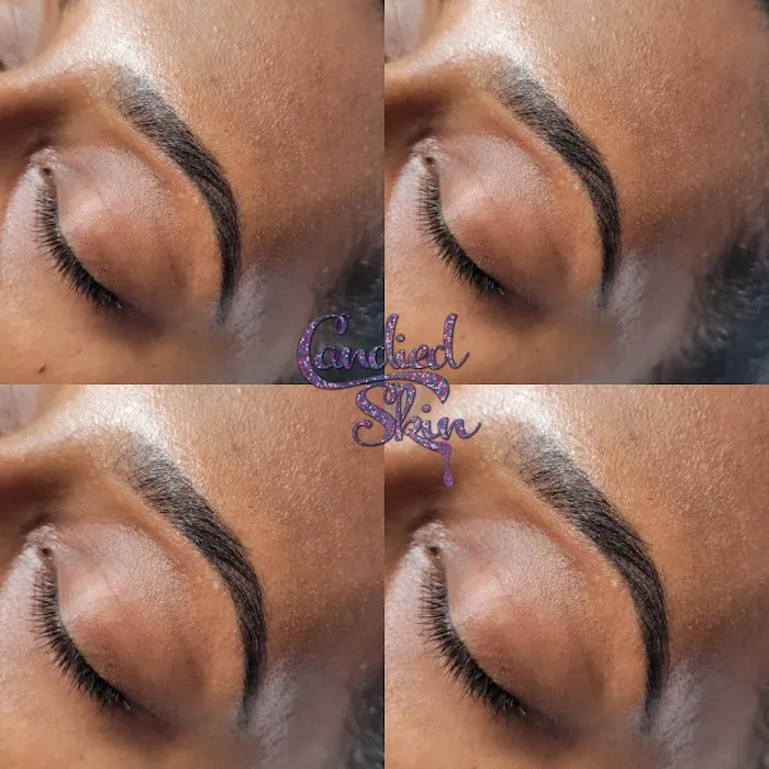 Candied Skin Picture 5