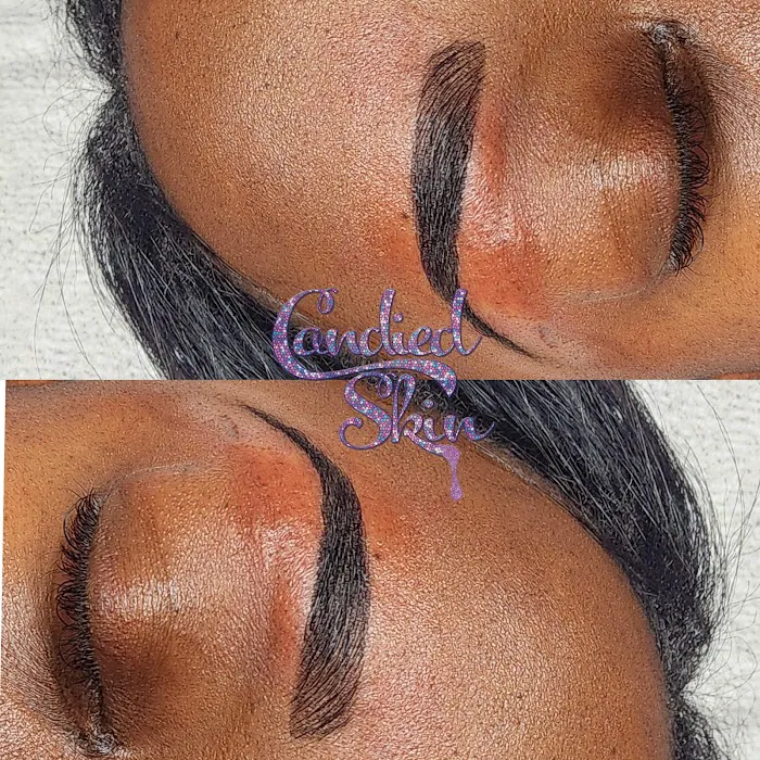 Candied Skin Picture 6