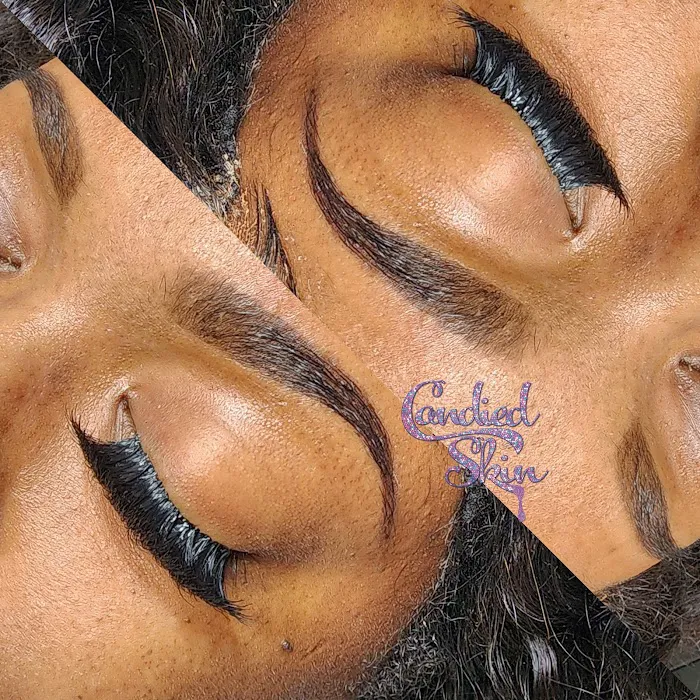 Candied Skin Picture 4