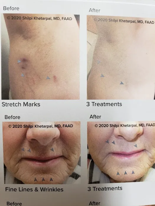 Eastside Dermatology Picture 8