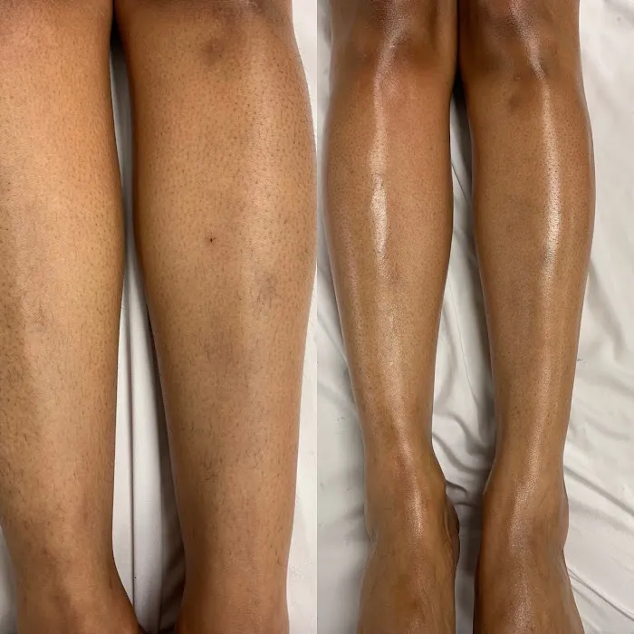 Hunter Harper Skin Picture 3