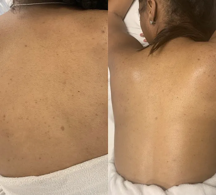 Hunter Harper Skin Picture 5