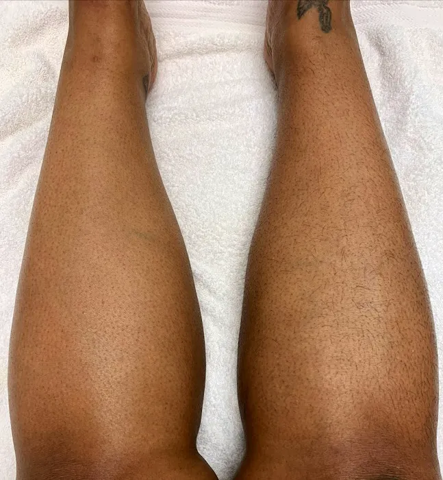 Hunter Harper Skin Picture 4