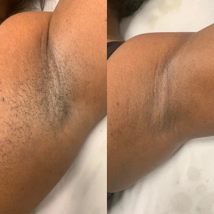 Hunter Harper Skin Picture 7