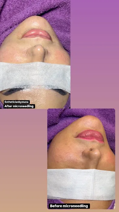 Estheticianbymuna Picture 8