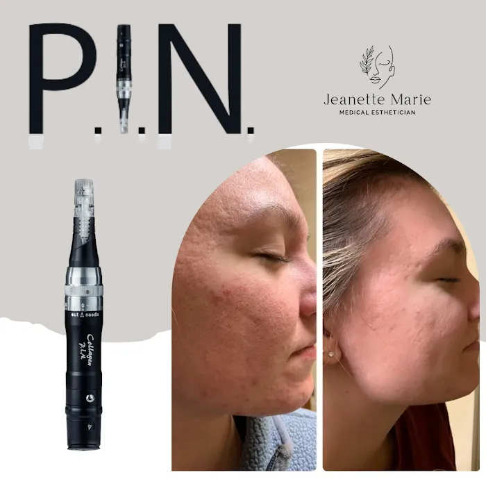 Jeanette Marie Medical Esthetician Picture 9