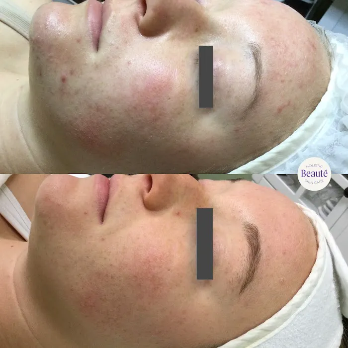 Beauté Holistic Skin Care Picture 6