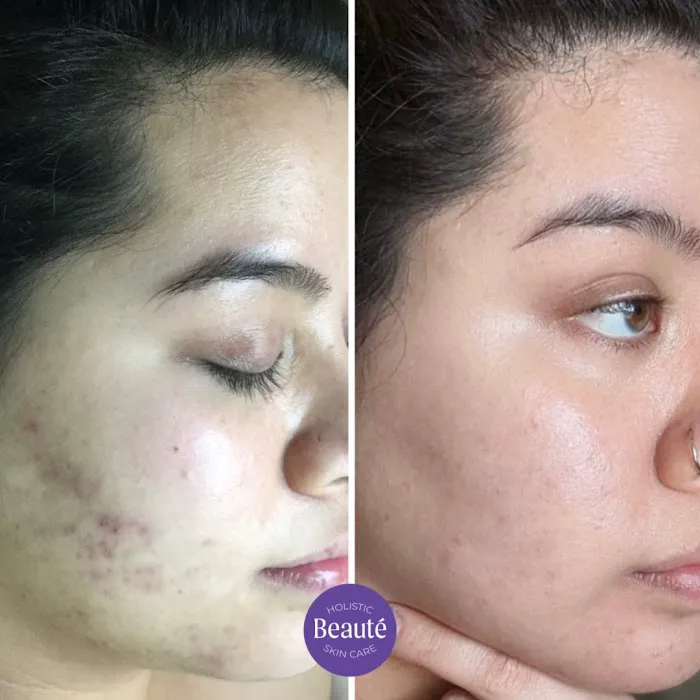 Beauté Holistic Skin Care Picture 8