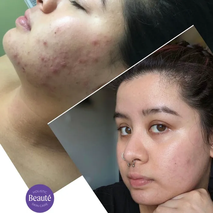 Beauté Holistic Skin Care Picture 10