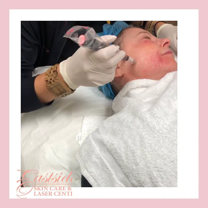Eastside Skin Care & Laser Center Picture 3