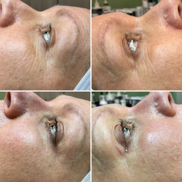 Smooth Solutions Picture 7