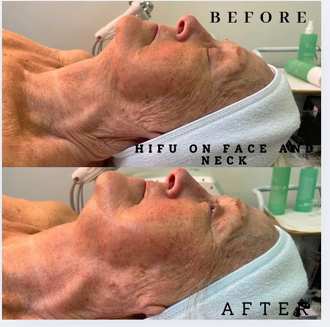 Luminous glow skin bar Picture 8