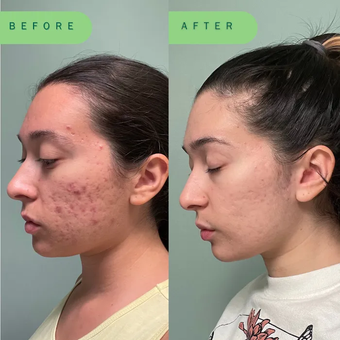 Skin Nutritious • holistic acne clinic Picture 3
