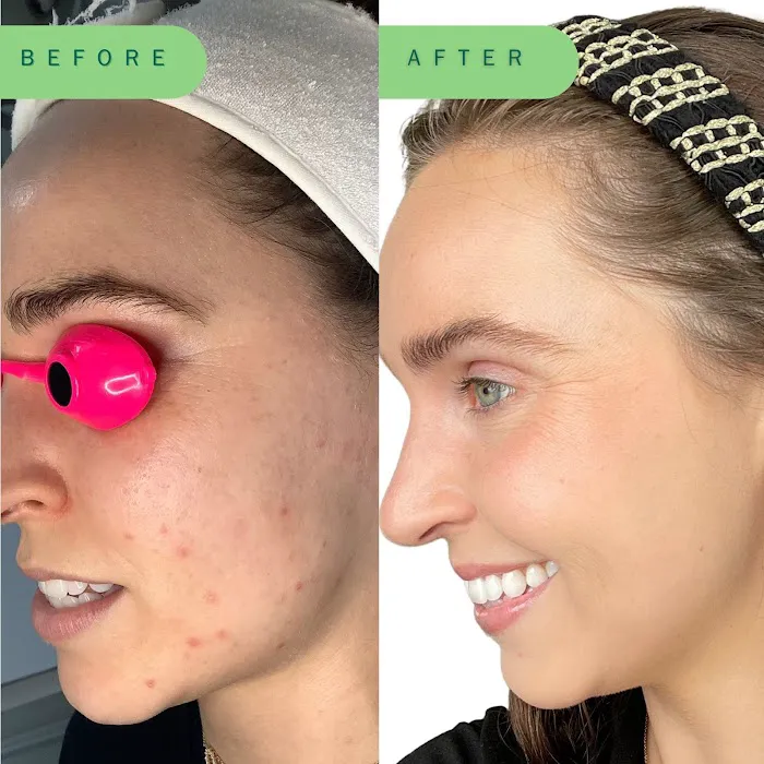 Skin Nutritious • holistic acne clinic Picture 5