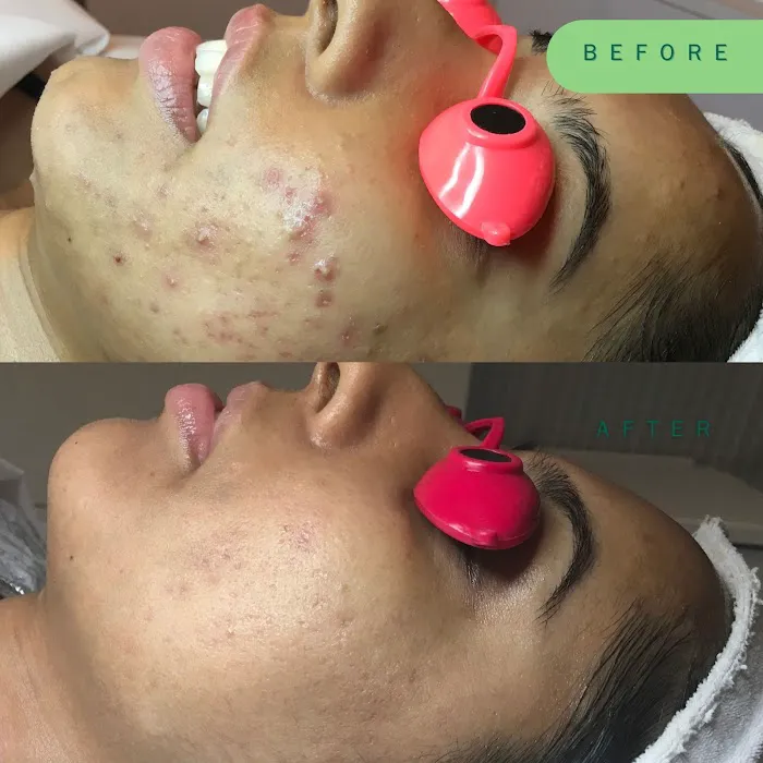 Skin Nutritious • holistic acne clinic Picture 7