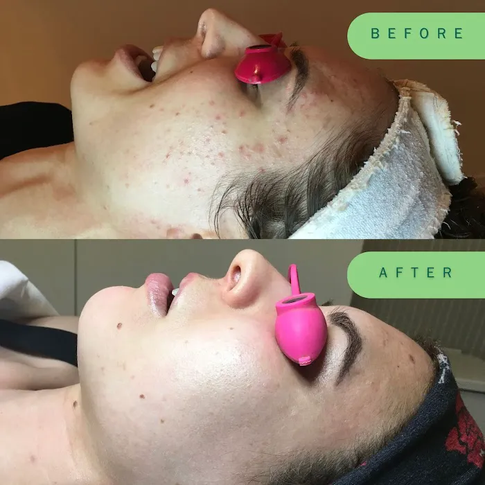 Skin Nutritious • holistic acne clinic Picture 6